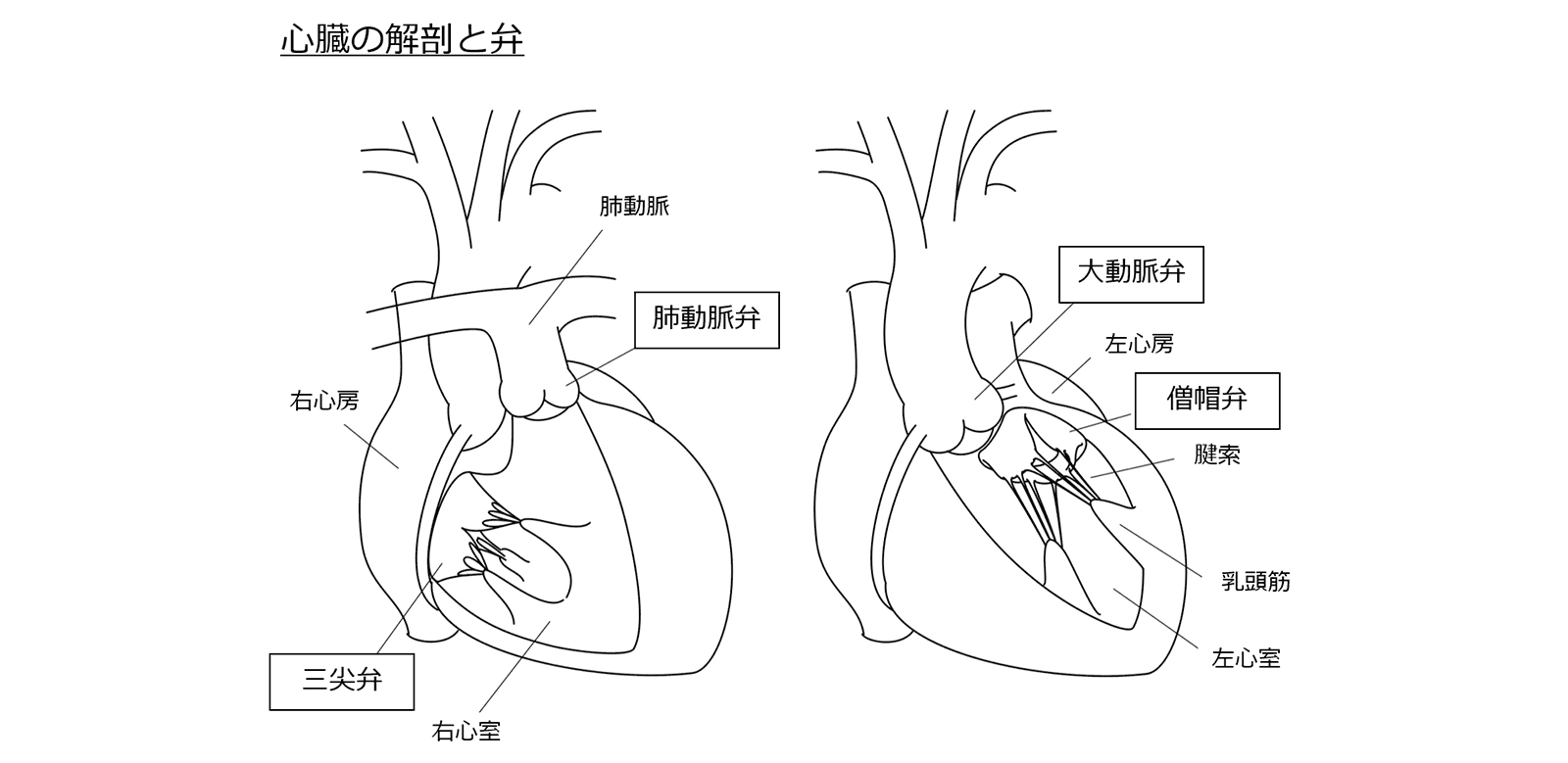 弁膜症手術